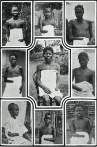 Mutilated Victims Twain 1905: 40